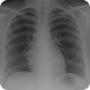 icon Radiology Tutor voor Inoi 6