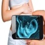 icon Ultrasound Scanner